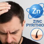 Manfaat Zinc Pyrithione untuk Atasi Ketombe Membandel